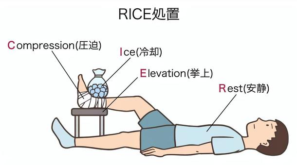 RICE処置